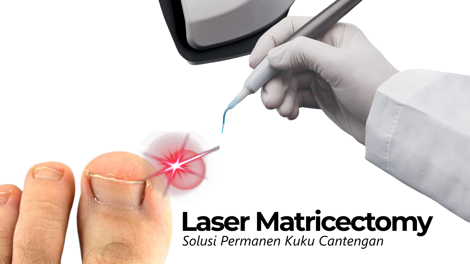 Perawatan Kuku Profesional